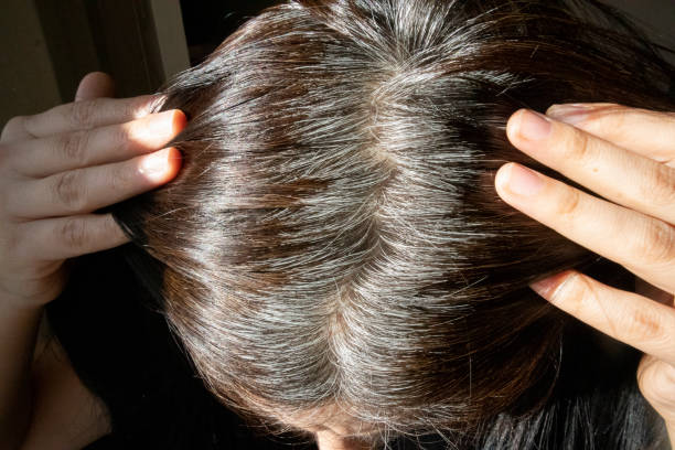 Bí quyết giúp đẩy lùi tóc bạc sớm đúng chuẩn khoa học!