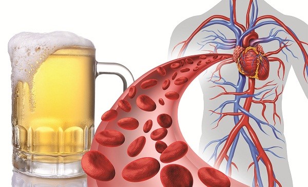 Ảnh hưởng của rượu bia tới các bệnh lý về tim mạch