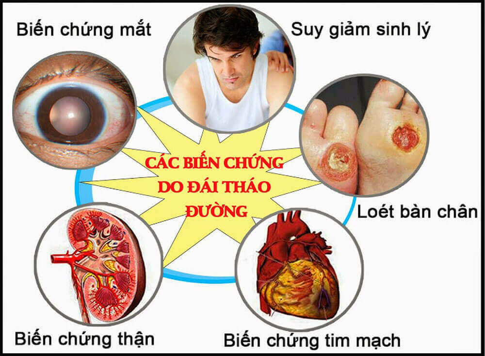 Biến chứng mắt ở bệnh nhân tiểu đường