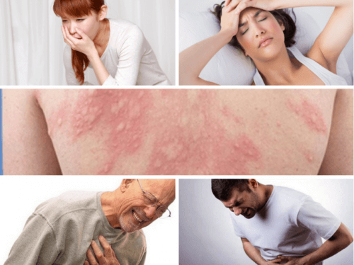 Những biểu hiện thường thấy khi sốc phản vệ
