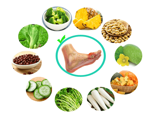 chế độ ăn trong bệnh gout