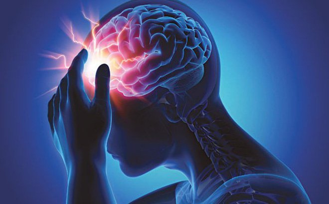 điều trị tai biến mạch máu não
