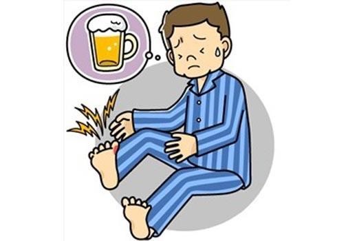 Nguy cơ bệnh gút từ việc uống nhiều rượu bia