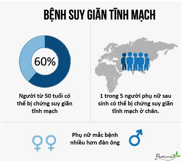 bệnh suy giãn tĩnh mạch
