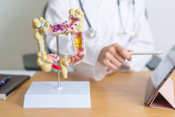 Các nguyên nhân gây rối loạn tiêu hóa thường gặp
