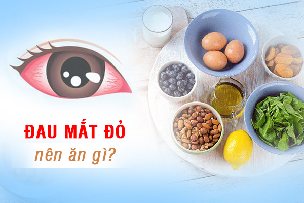 Đau mắt đỏ nên ăn gì?