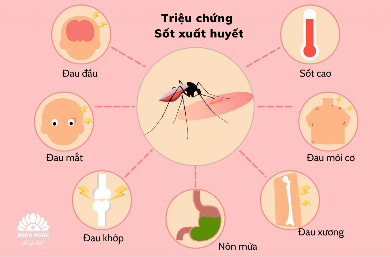  Các triệu chứng sốt xuất huyết.
