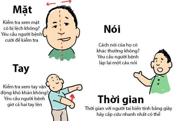 Dấu hiệu nhận biết đột quỵ.