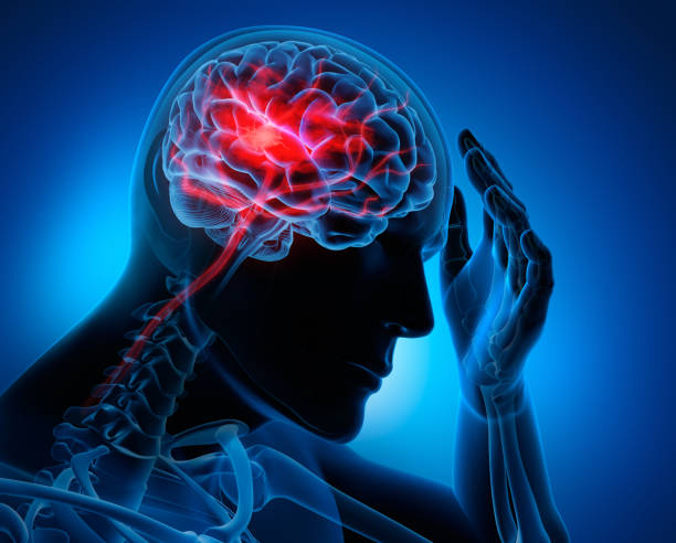 Tỷ lệ người trẻ bị đột quỵ ngày càng gia tăng