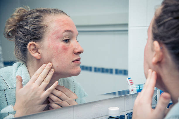 Mùa rét: Nhiều người khổ vì da khô nứt nẻ