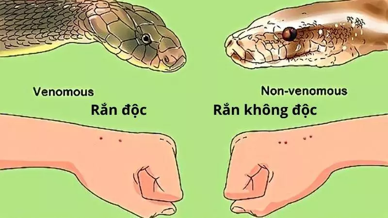 Nhận biết rắn cắn qua vết răng để lại trên da