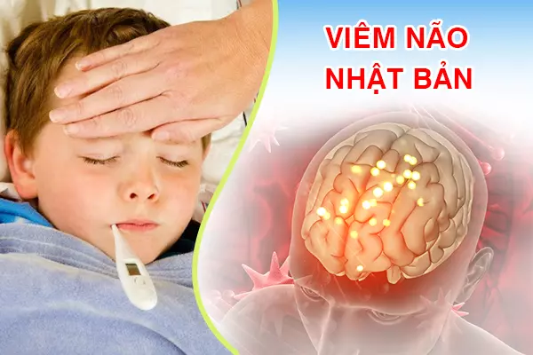 Viêm não Nhật Bản - Đừng chủ quan với căn bệnh này?
