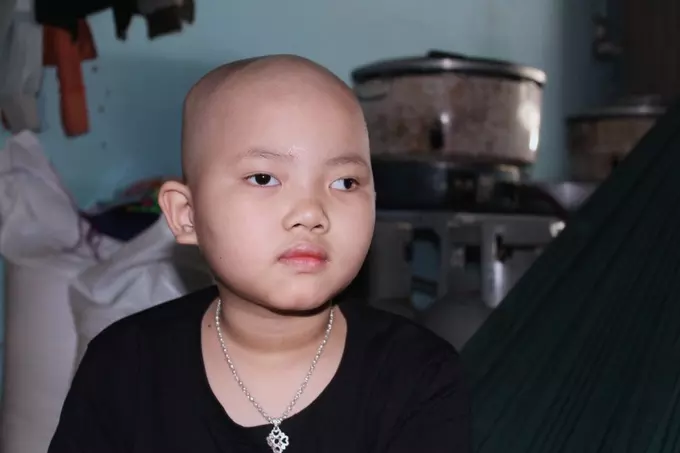 Bé Bình An với con mắt bị tổn thương (nguồn: Dân trí)