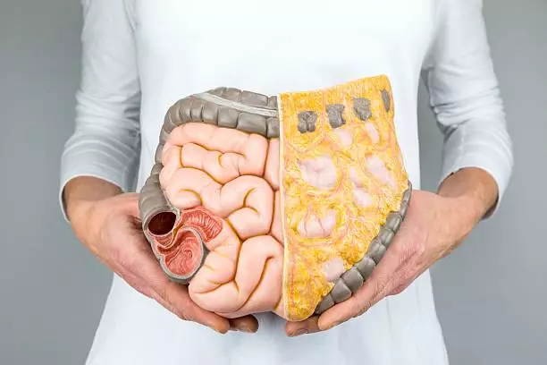 Mỡ nội tạng ở người béo phì ngăn chặn tác dụng của insulin.