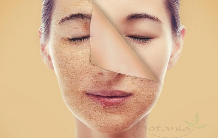 Ánh sáng xanh từ màn hình máy tính gây khô da