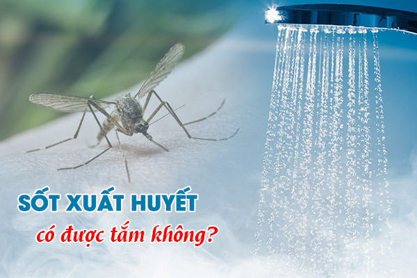 Sốt xuất huyết có được tắm không? Cần lưu ý gì để bệnh nhanh khỏi?