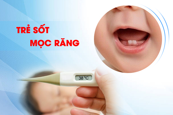 Sốt mọc răng ở trẻ: Những điều cha mẹ cần biết