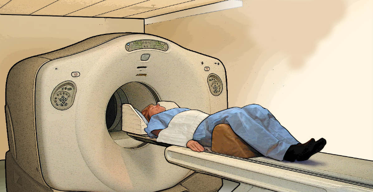 Chụp PET-CT giúp tầm soát ung thư phổi