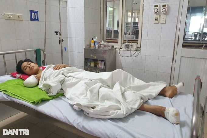 Bị điện giật đã để lại di chứng kinh hoàng trên cơ thể cậu bé người Dao