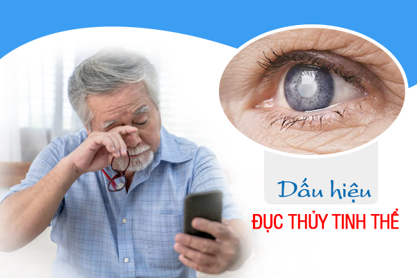 Dấu hiệu đục thủy tinh thể và cách điều trị