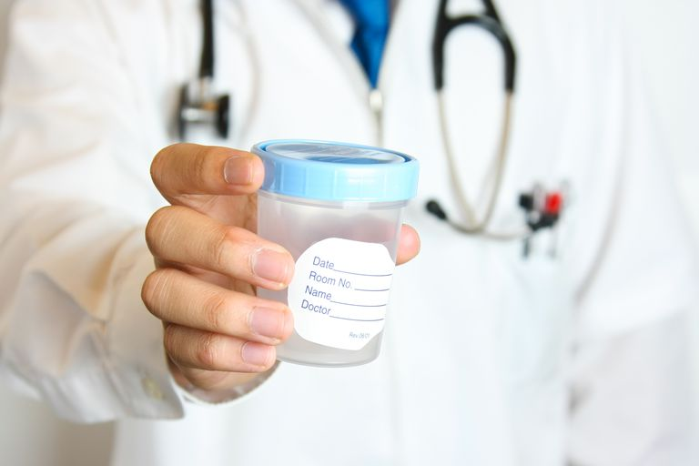 Nam giới xét nghiệm tinh dịch đồ để kiểm tra sức khỏe sinh sản
