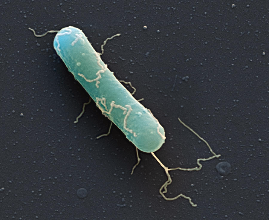 Vi khuẩn Clostridium botulinum gây ngộ độc thực phẩm