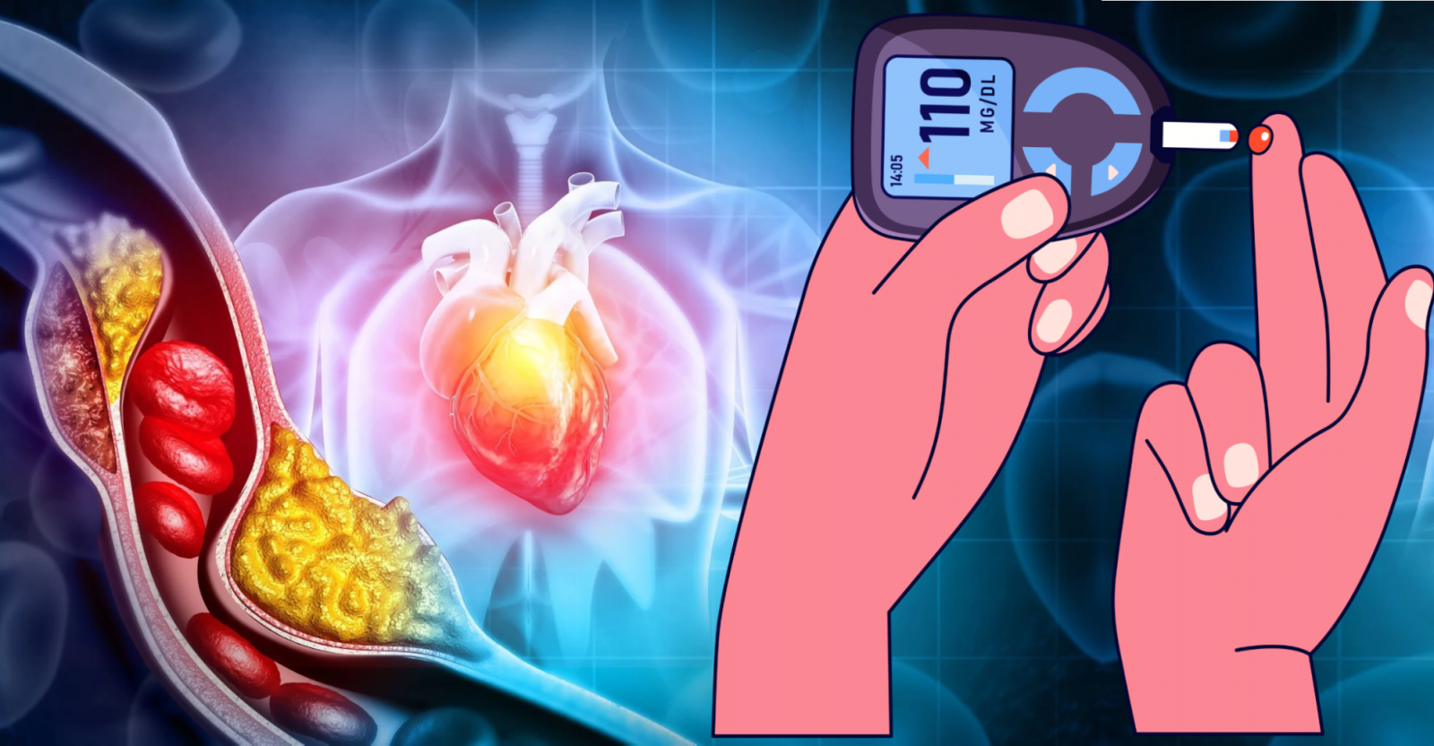 Người bệnh tiểu đường có mỡ máu cao dễ gặp biến chứng trên tim mạch
