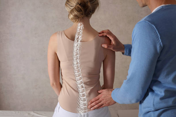 Vẹo cột sống: Nguyên nhân, triệu chứng và phòng ngừa vẹo cột sống
