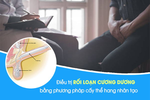 Phương pháp cấy ghép thể hang nhân tạo trong điều trị rối loạn cương dương