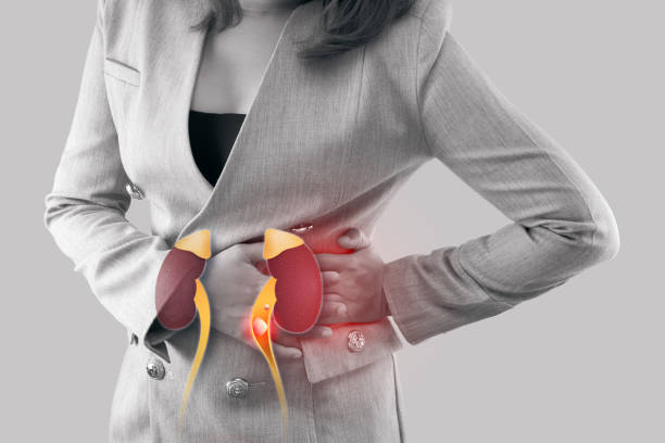 Tại sao nhiều người Việt bị sỏi tiết niệu?
