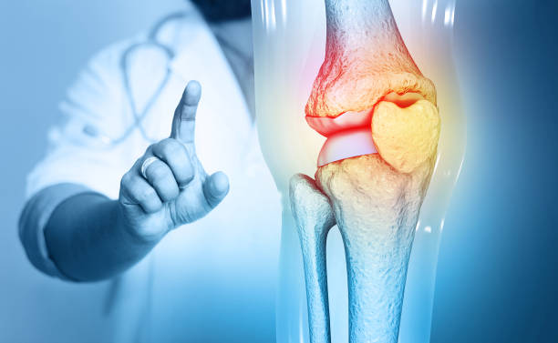 Các bệnh xương khớp dễ gặp ở dân văn phòng
