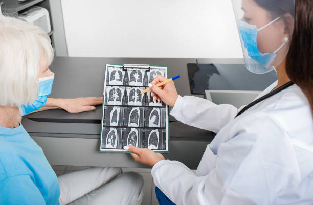 Tầm soát đột quỵ: Nên hay không?