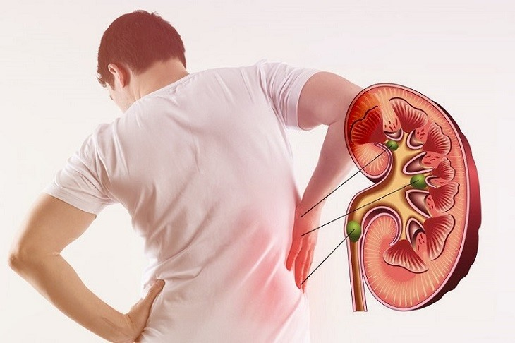 Nguyên nhân suy thận ở người trẻ