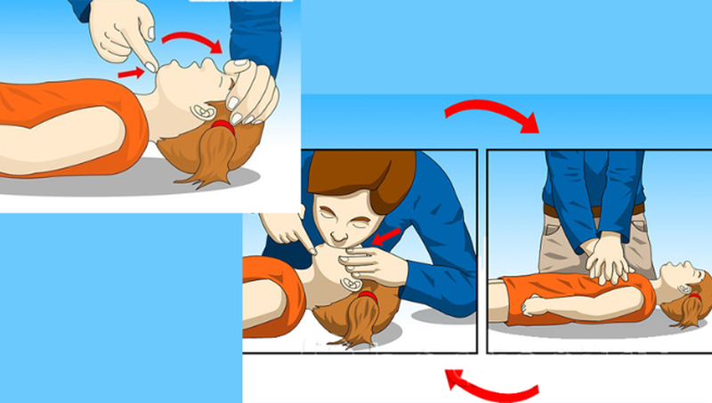 Hà hơi thổi ngạt nếu bệnh nhân thở yếu hoặc ngừng thở