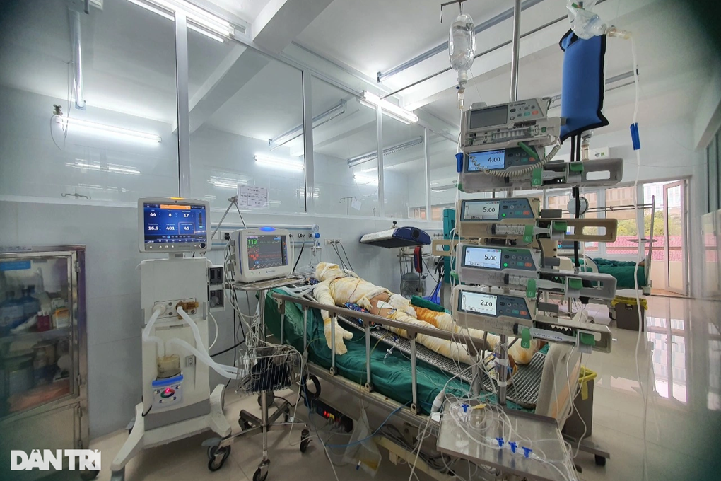 Bố bỏng 57% cơ thể, con trai dằn vặt muốn thôi học đại học - 2
