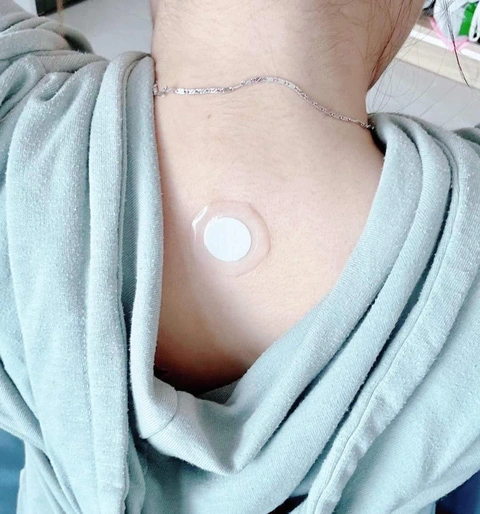 Miếng dán được cho là tác dụng kích hoạt tế bào gốc thải độc