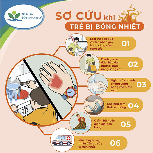  Hướng dẫn sơ cứu khi trẻ bị bỏng.