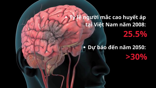 Tỷ lệ tăng huyết áp năm 2050 ước tính có  thể lên tới trên 30%.