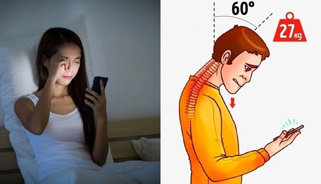 Nhiều người trẻ Việt mắc hội chứng cổ rùa vì 