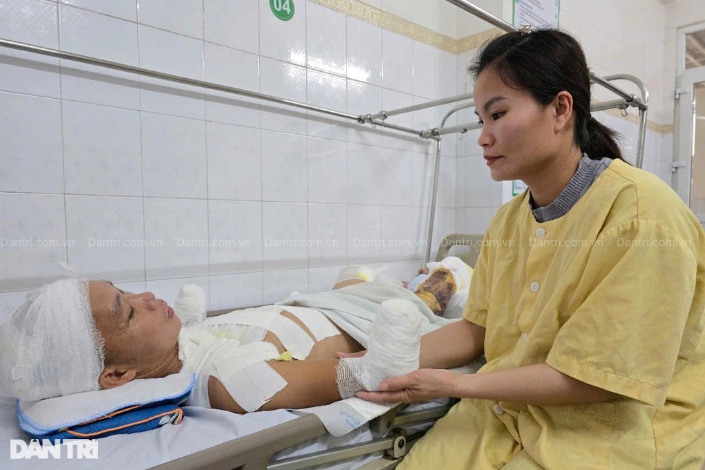 Anh Lợi mất 2 tay, 1 chân vì bỏng điện: Em biết làm gì để nuôi con? - 5